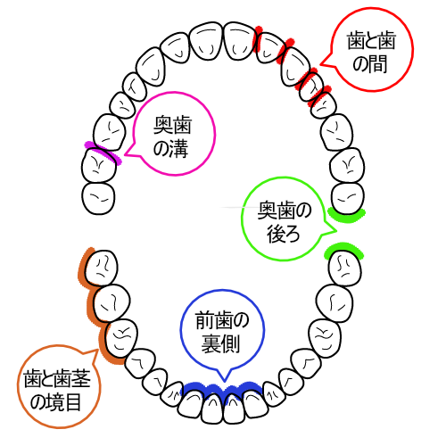 歯磨きで念入りに磨いてほしい箇所